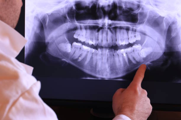 Best Emergency Dental Care for Sports Injuries in Hollywood Park, TX