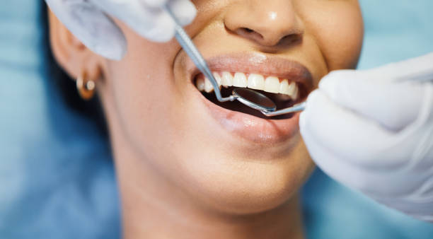 Best Emergency Care for Gum Disease in Hollywood Park, TX