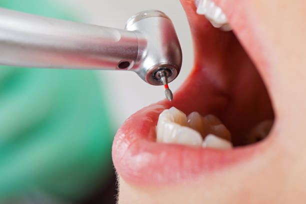 Best Urgent Dental Care for Toothaches in Hollywood Park, TX